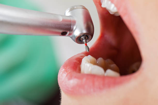 Best Same-Day Emergency Dentist in Lochsloy, WA